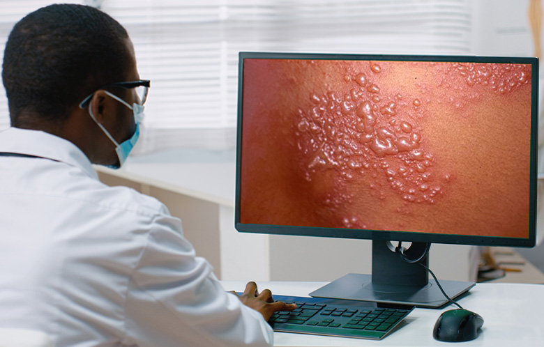 Doctor on desktop looking at dermatology photo